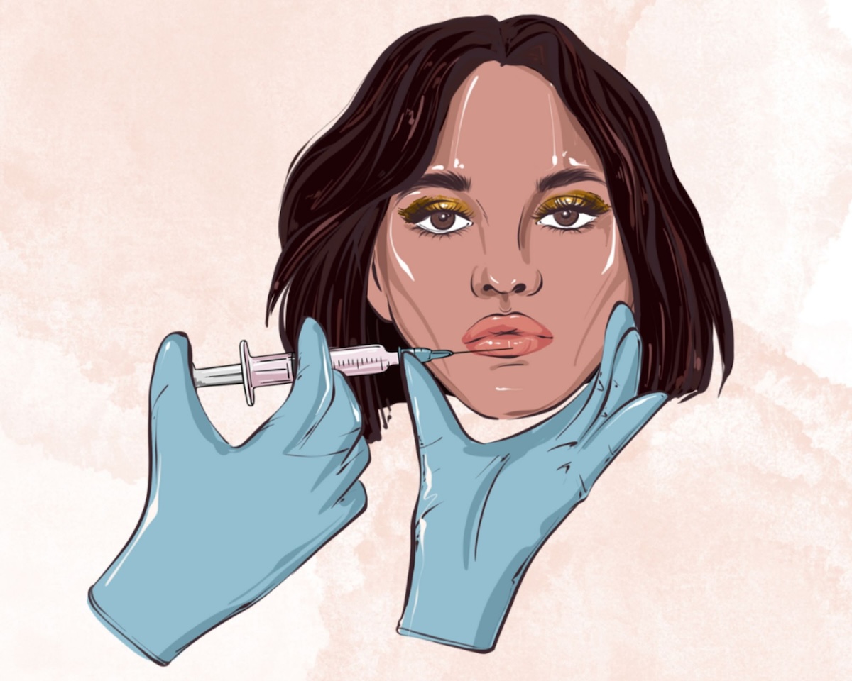 Lip Filler