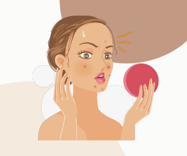 Skincare Products for Acne Prone Skin Skincare Products for Acne Prone Skin