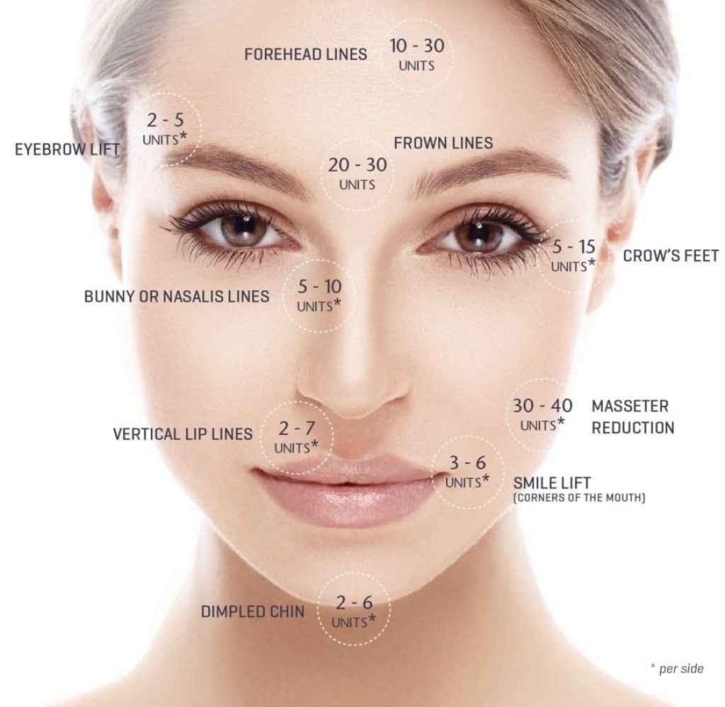 anti wrinkle botox treatment